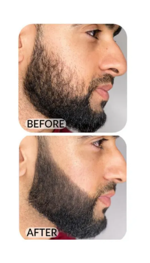 Hair Filler Pen – Fills Beard Patches, Defines Brows & Hairlines | Matte Finish by Larry Looks Waterproof