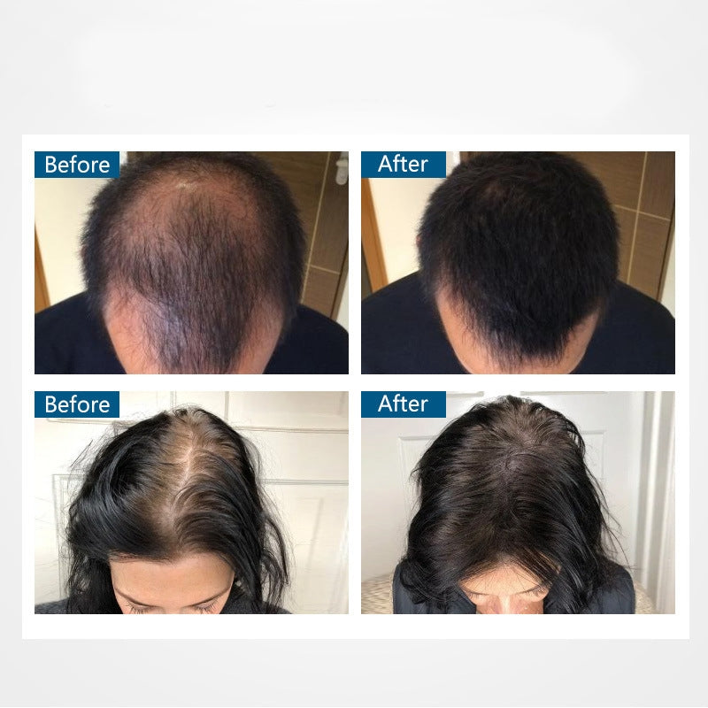 Hair Building Fiber & Easy Apply Pump Set | Thickening Powder with Spray for Men & Women | Hairline Solution